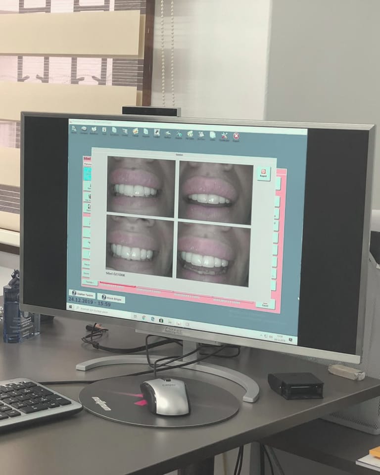 Desk with the smile design screen